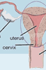 Hysterectomy Information